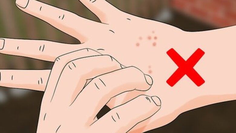 How to Treat Oak Mite Bites