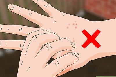 How to Treat Oak Mite Bites
