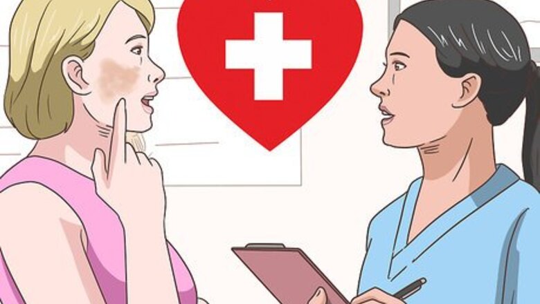 How to Treat Melasma