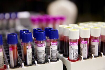 Decoding Long Covid: A Haematologist Tells Us Why Gum and Nose Bleeds Post Covid Need Attention