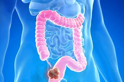 5 Early Signs Of Colon Cancer You Should Never Ignore
