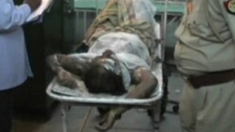 Dalit woman burnt alive in UP village