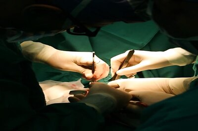 Odisha Twins Joined at Head Separated After Marathon 16-Hour Surgery