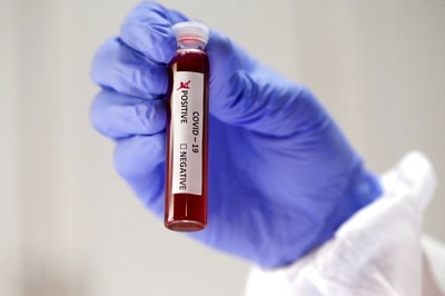 World Blood Donor Day 2020: 7 Reasons Why You Should Donate Blood