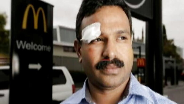 Indian Assaulted in Australia, Called 'You Bloody Black Indians'