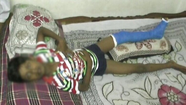 Teacher beats up class 3 student, fractures his leg for refusing to massage his feet