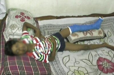 Teacher beats up class 3 student, fractures his leg for refusing to massage his feet