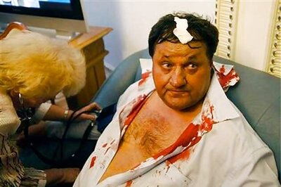 Fight in Ukraine's Parliament over language bill