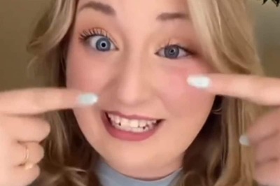 US Woman Issues Warning About Designer Sunglasses After Losing Eye In Minor Car Accident