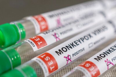 Monkeypox Vs Chickenpox: Difference in Way Symptoms on Both Diseases Manifest in Patients, Say Doctors