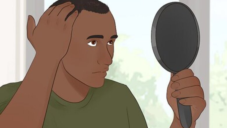 How to Treat & Cover Thinning Hair for Men: Expert Tips