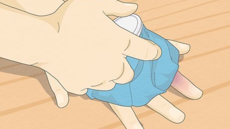 Unjam & Treat a Jammed Finger for Quick Relief