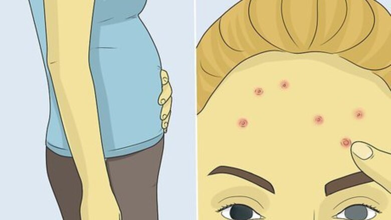 How to Deal with Periods if You Are Blind or Visually Impaired