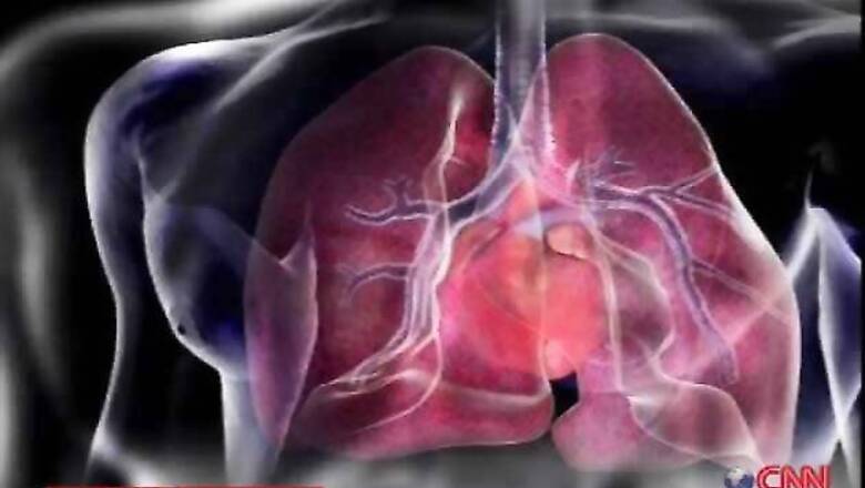 Olive oil may revive a failing heart: Study