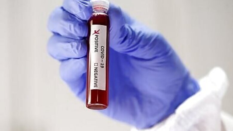 Coronavirus Re-infections Raise Concerns About Immunity