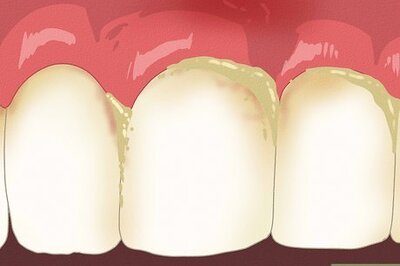 How to Stop Itchy Gums