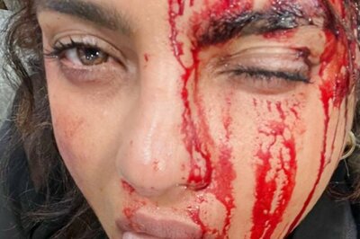 Priyanka Chopra Sports Bloody Face On Sets Of Citadel, Says 'Shoulda Seen The Other Guy'