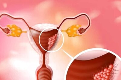 Women Suffering From Diabetes Prone To Uterine Cancer: ICMR