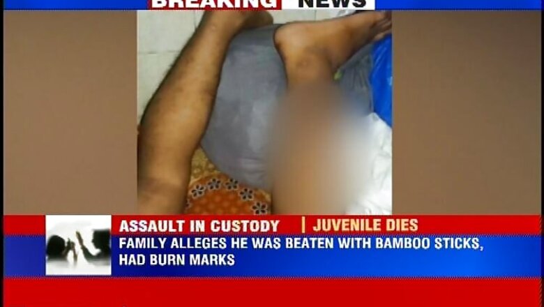 17-year-old boy sodomised, brutally assaulted, dies in custody at Mumbai Juvenile Home