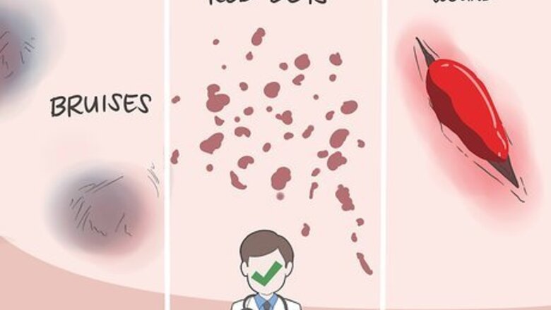 How to Overcome Platelet Deficiency