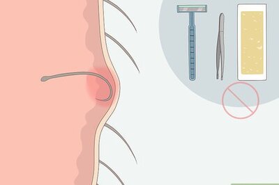 How to Get Rid of Hair Bumps on Your Private Area
