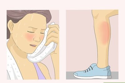How to Treat Hyperthermia