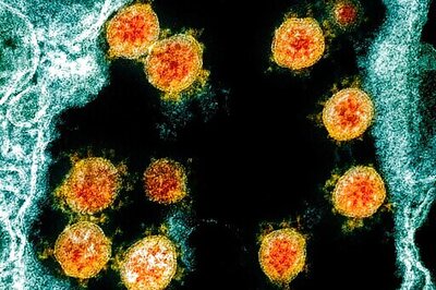 Mild To Severe: Immune System Holds Clues To Virus Reaction