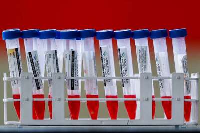 Omicron: ICMR Report on South African Traveller's Covid Sample to Arrive in 2 to 3 Days, Says K'taka Min