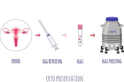 Egg Freezing: The Pros, Cons, and Everything You Need to Know