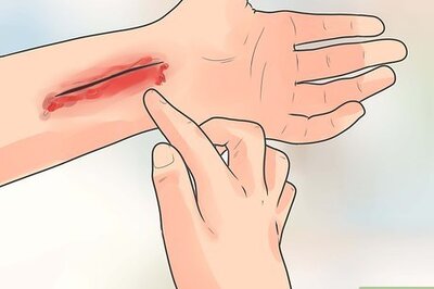How to Treat a Minor Cut