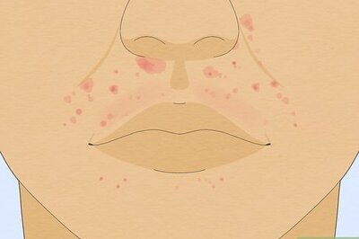 How to Treat a Face Rash After Waxing