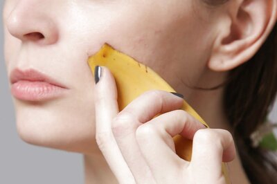 Here's How Banana Peels can Treat Acne and Pigmentation, Read on