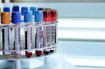 Blood Test Can Detect Signs Of Breast Cancer as Early as 5 Years, Researchers Say