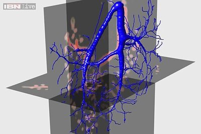 New technology analyses 3D images of complex biological structures