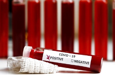 One Lakh Kits to Reach Tamil Nadu From China on Thursday to Aid Quick Screening: CM Palaniswami