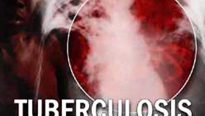 Drug resistance in TB has increased in India: Dr MS Kanwar