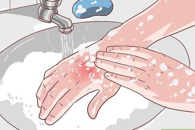 How to Heal a Cigarette Burn