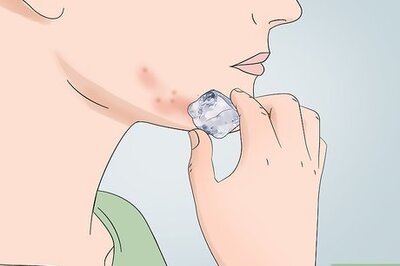 How to Cover Inflamed Pimples