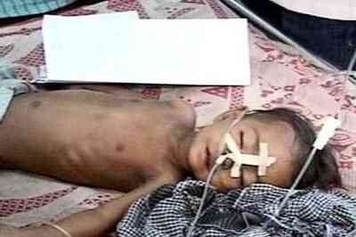 West Bengal: One more dies of Encephalitis, toll mounts to 217