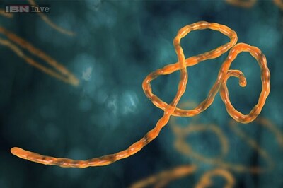 New rapid diagnostic test detects Ebola virus in minutes