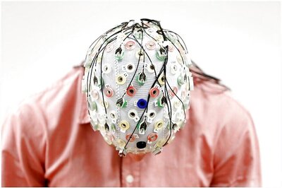 Microbleeds After Head Injury May Worsen Outcomes: Study