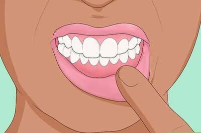 How to Treat White Gums: Your Top Questions Answered