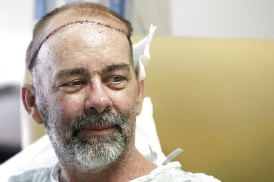US doctors perform world's first skull-scalp transplant