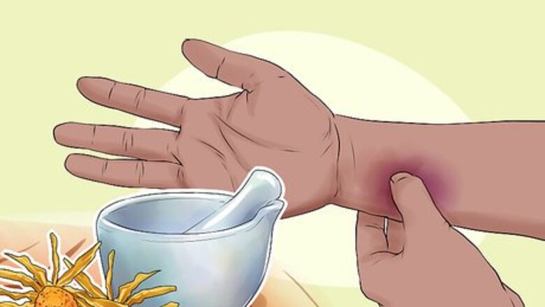 How to Use Herbs for Sprains and Bruises