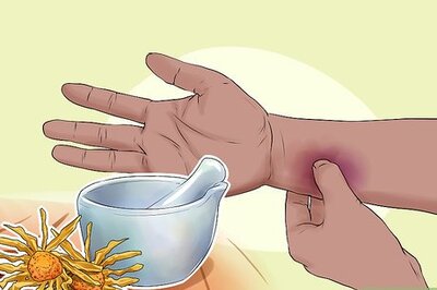 How to Use Herbs for Sprains and Bruises