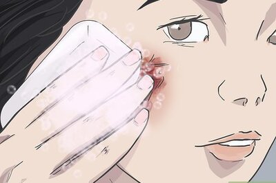 How to Prevent Scarring on Your Face