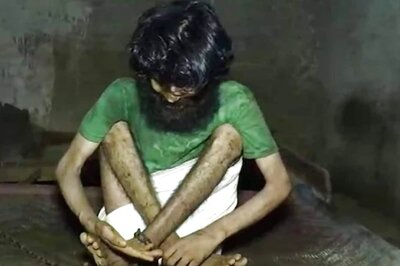 Chained for 10 Years by Family, Mentally Challenged Man Rescued by NGO in Haryana