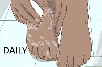 How to Stop Your Feet from Sweating