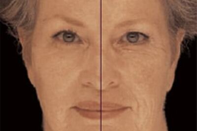 Iron your wrinkles over a cup of coffee!