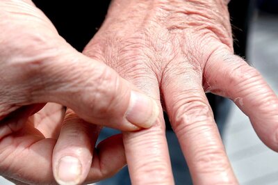 The Critical Role of Weight Management in Arthritis Prevention